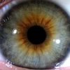 Iris mixte